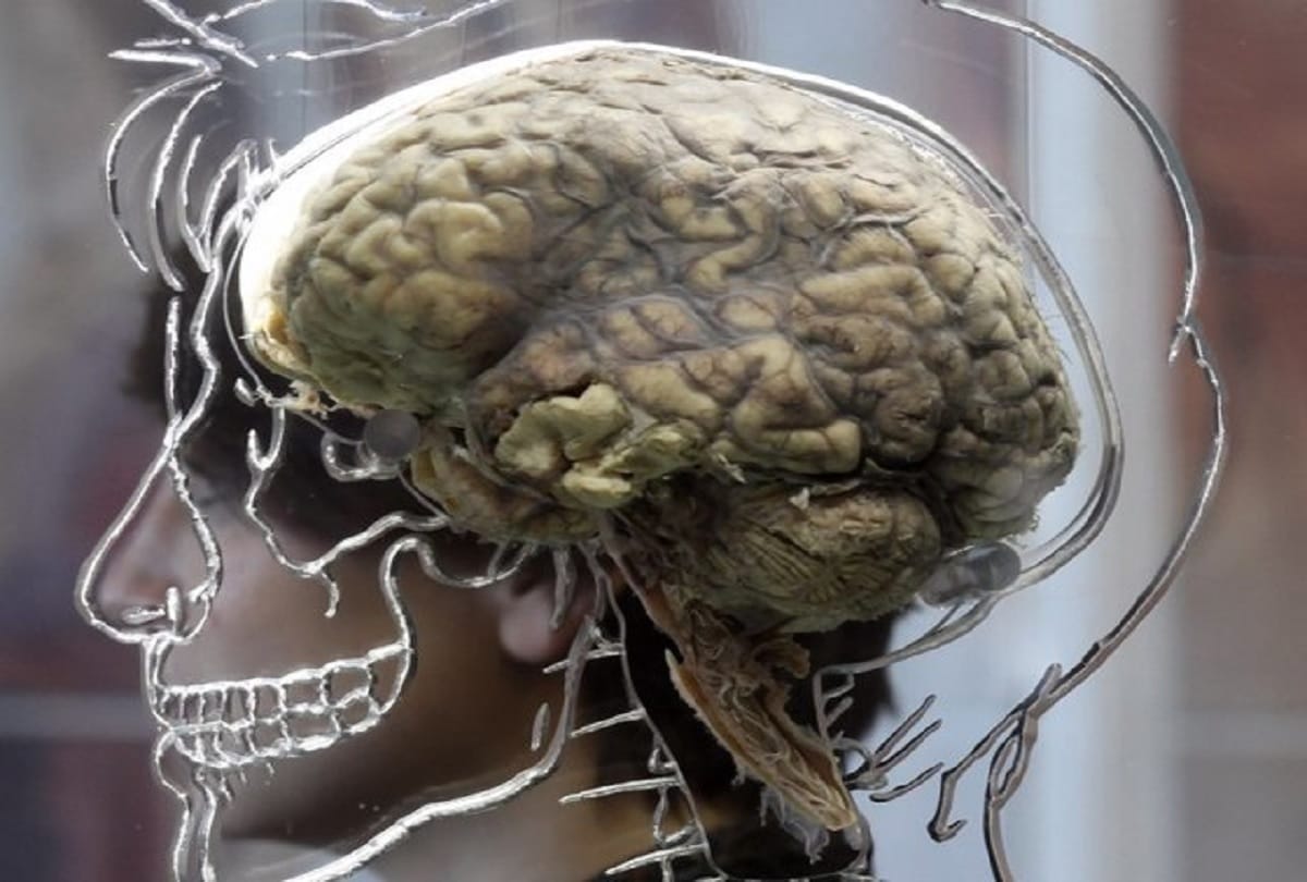 world alzheimer day Your memory can weaken by red meat