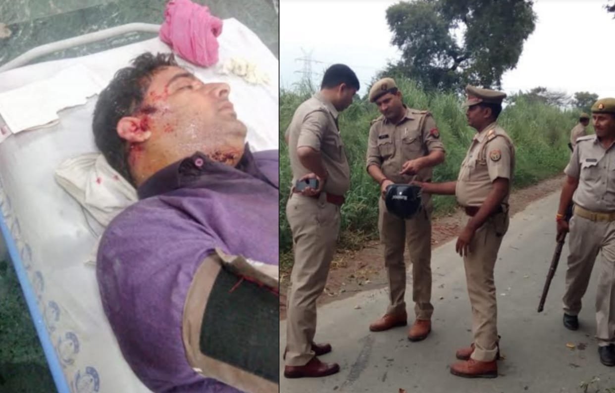 UP: badmash attacked a private doctor Against robbery in Bagpat