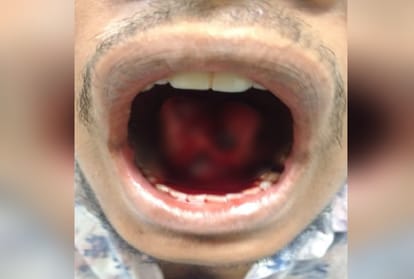 woman cut husband tongue by teeth in delhi