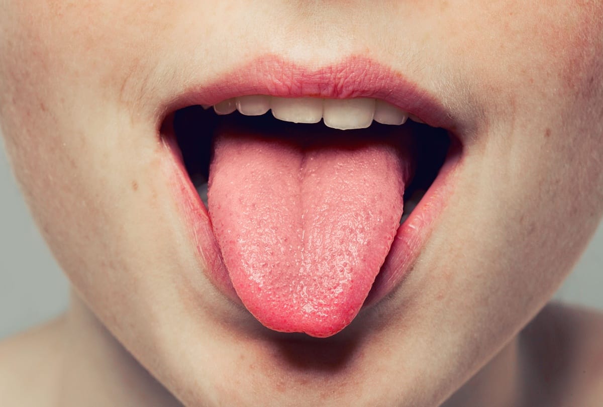 change in tongue colour means, know what expert says about this
