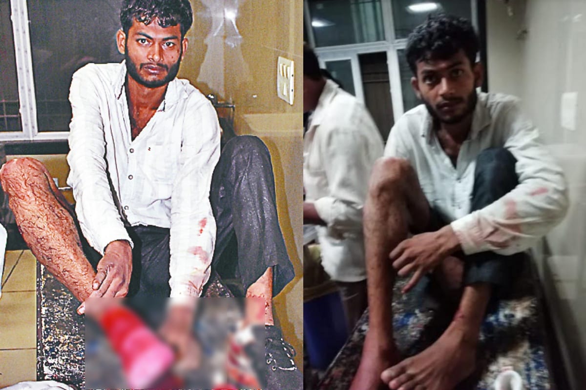 Encounter in meerut and accused  injured in police officers firing