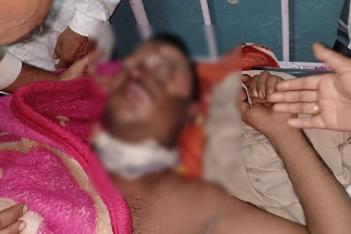 Saharanpur: people call a man at home and threw acid on his face and  attack with knives