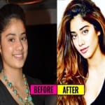janhvi kapoor plastic surgery