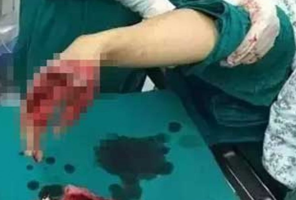 Husband attacked on wife in auraiya