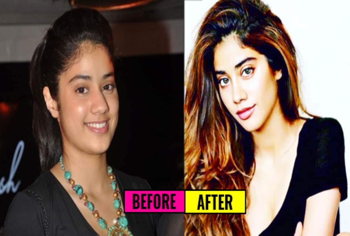 List of bollywood actresses who have had plastic surgery