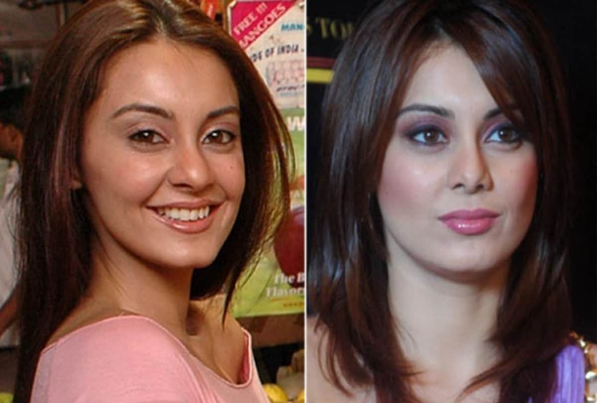 how Bollywood actresses looked before plastic surgery Anushka Sharma to Priyanka Chopra
