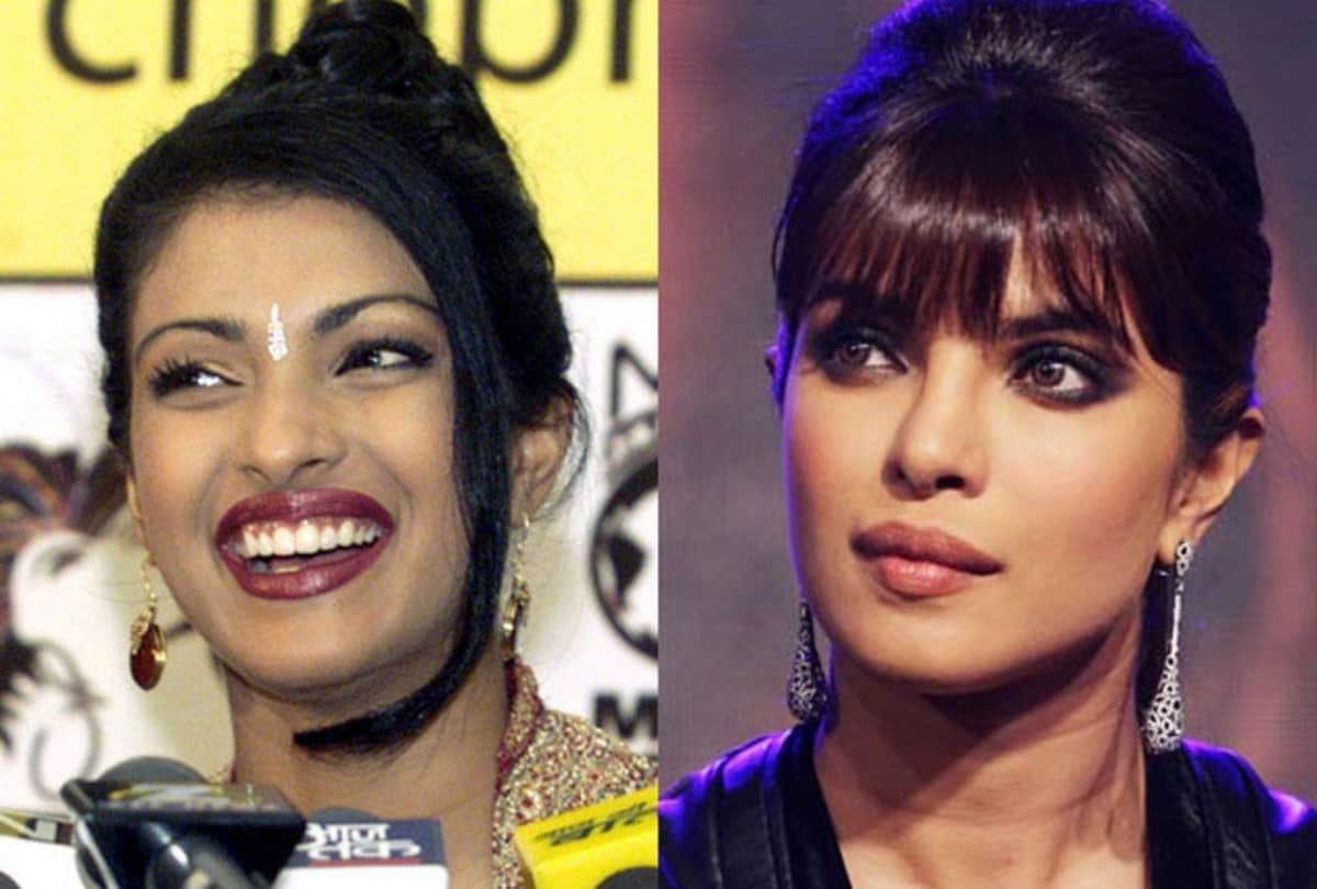 List of bollywood actresses who have had plastic surgery
