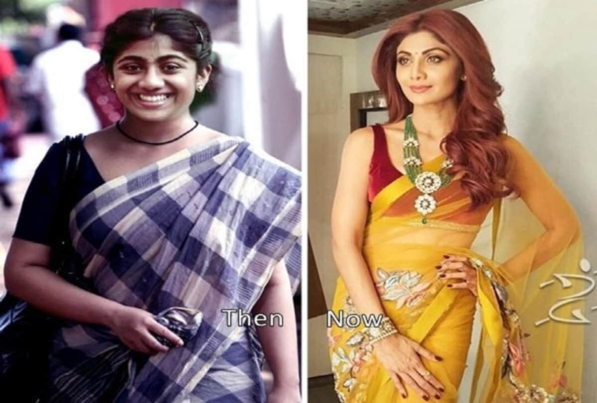 Anushka Sharma to Kangana Ranaut List Of Bollywood Actresses Who Have Had Plastic Surgery