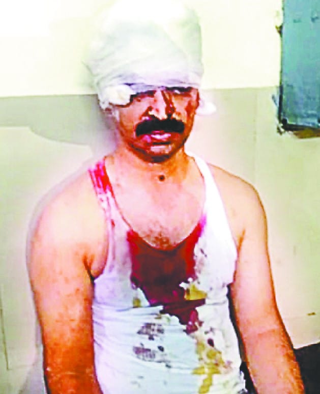 Raided by the Principal in the train, with a knife attack on protest