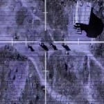 Surgical Strike