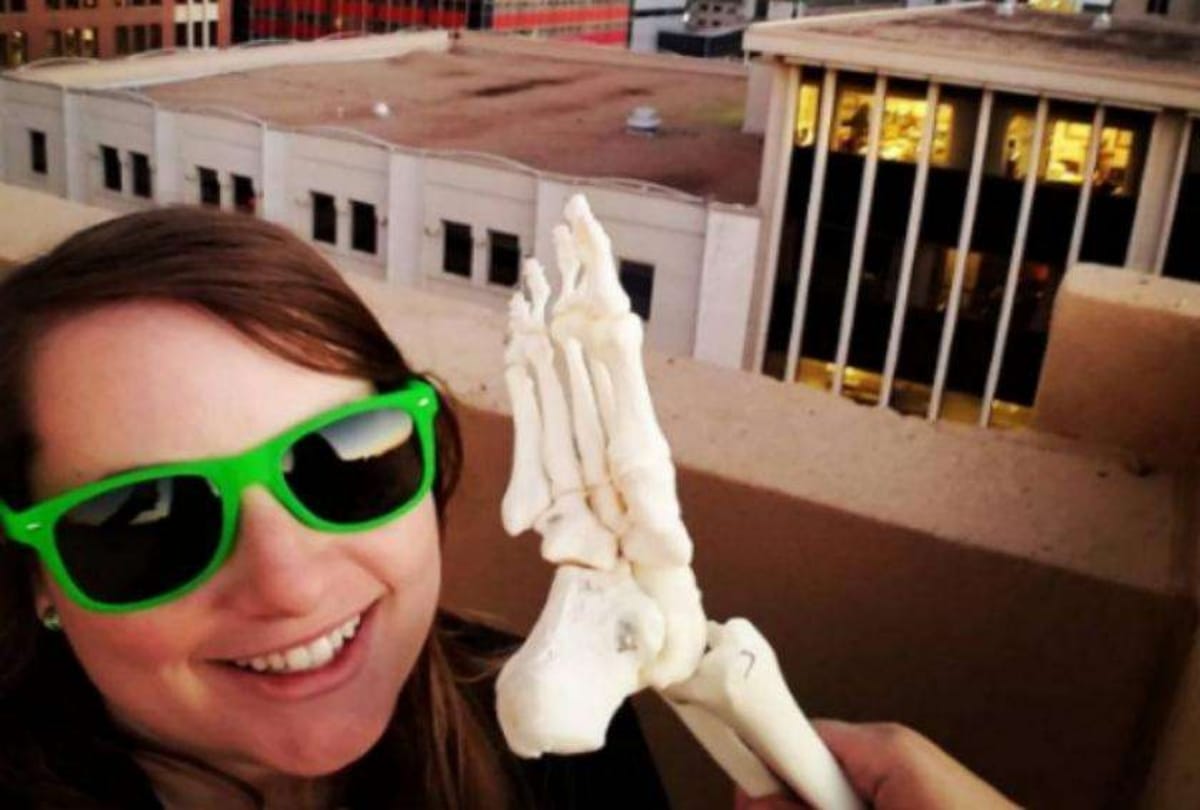 A wonder foot Girl keeps her leg Bone in america