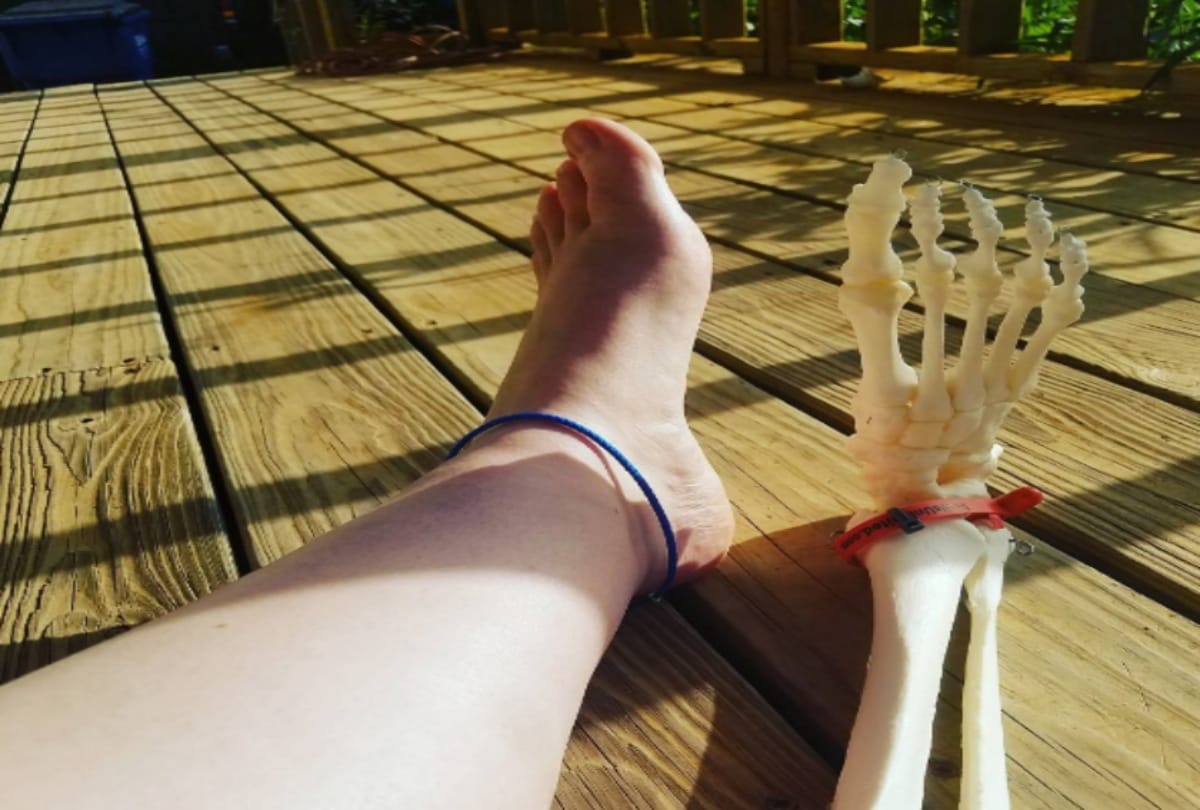 A wonder foot Girl keeps her leg Bone in america