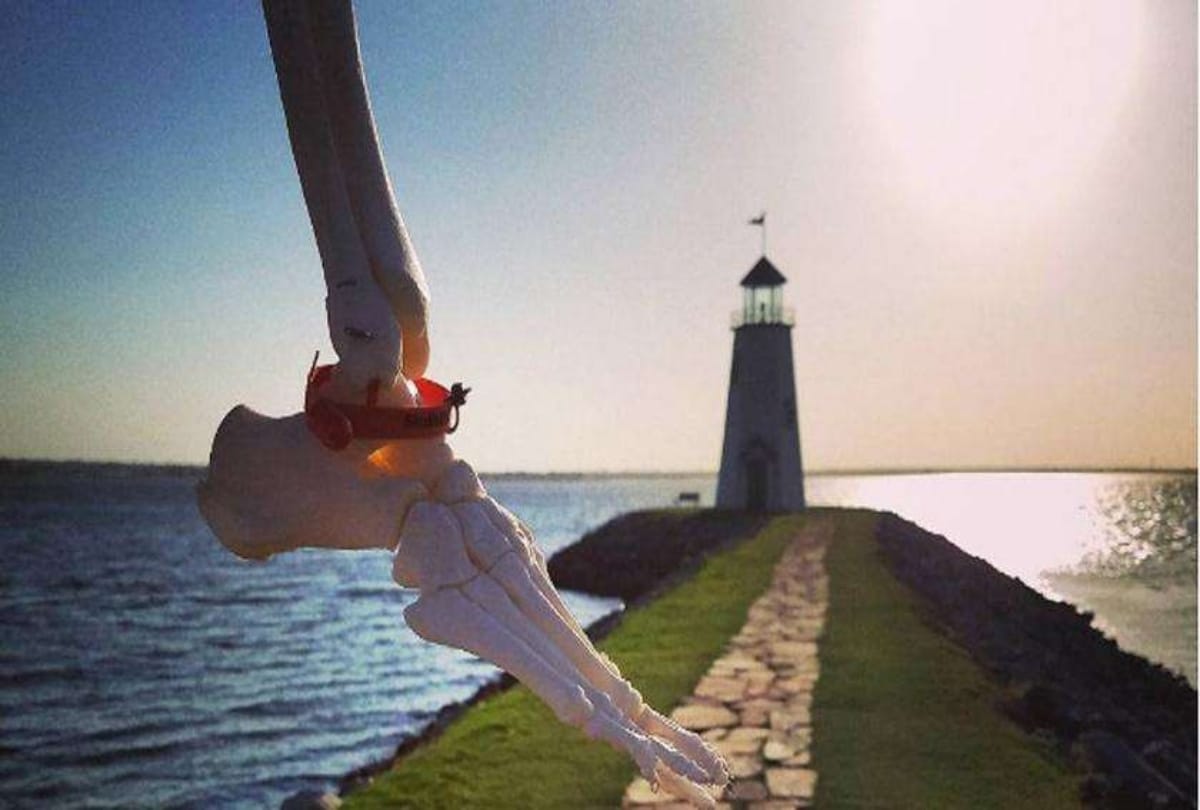 A wonder foot Girl keeps her leg Bone in america
