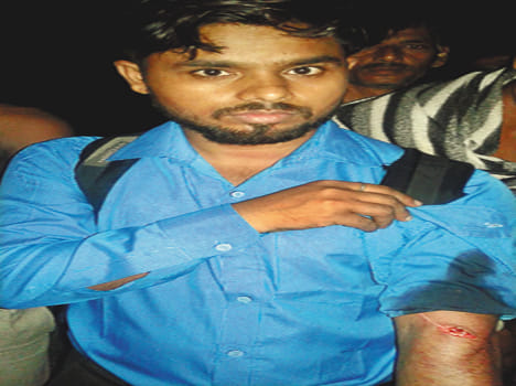 Chain snatch by compounder to hit knife in farrukhabad