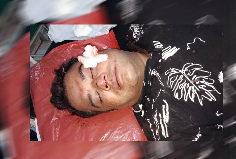 Car Accident on badrinath highway dead Body Rescue photos