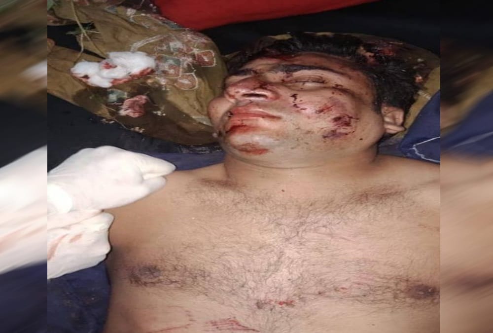 Car Accident on badrinath highway dead Body Rescue photos