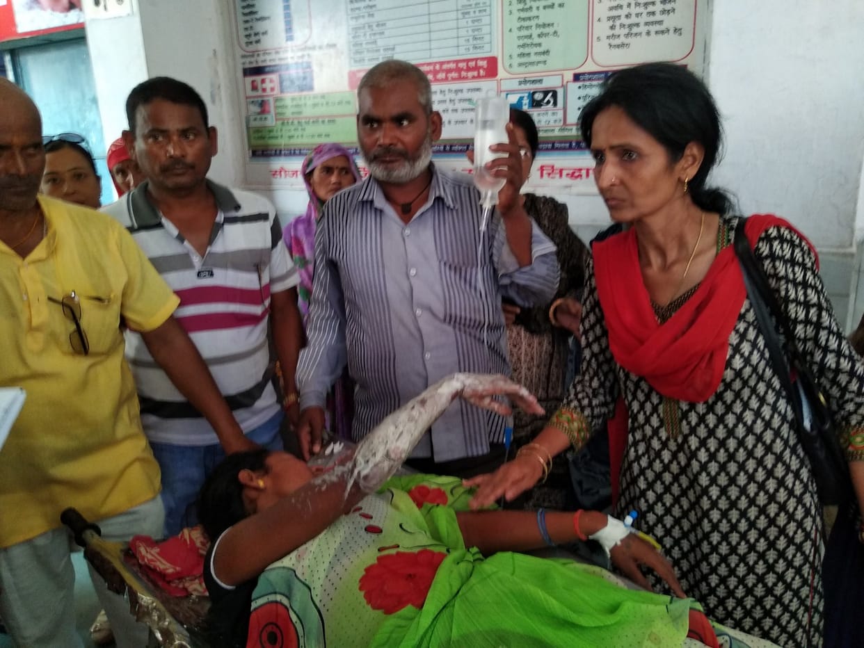 सिलिंडर से लगी आग, खाना बना रही रसोईया झुलसी