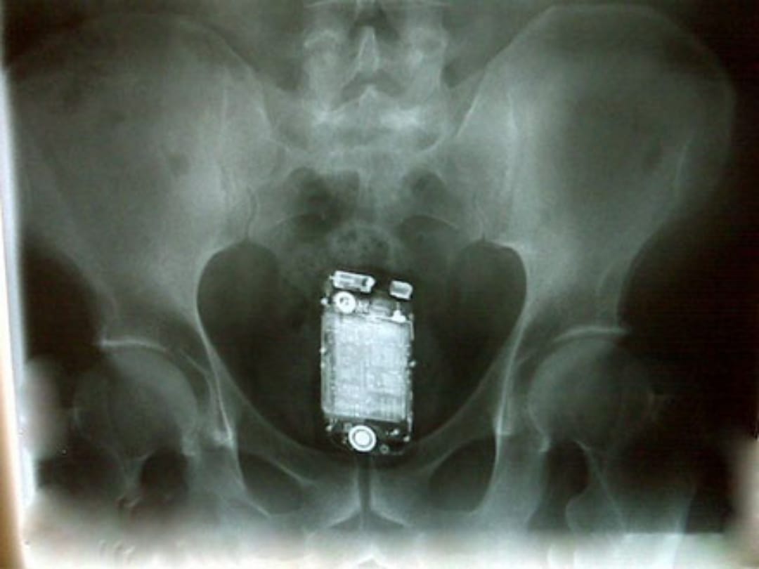 Prisoner swallowed phone during checking in kolkata presidency jail