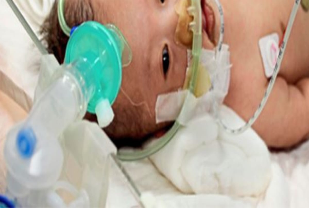 Mother gave accidentally acid in drink to her one year old child