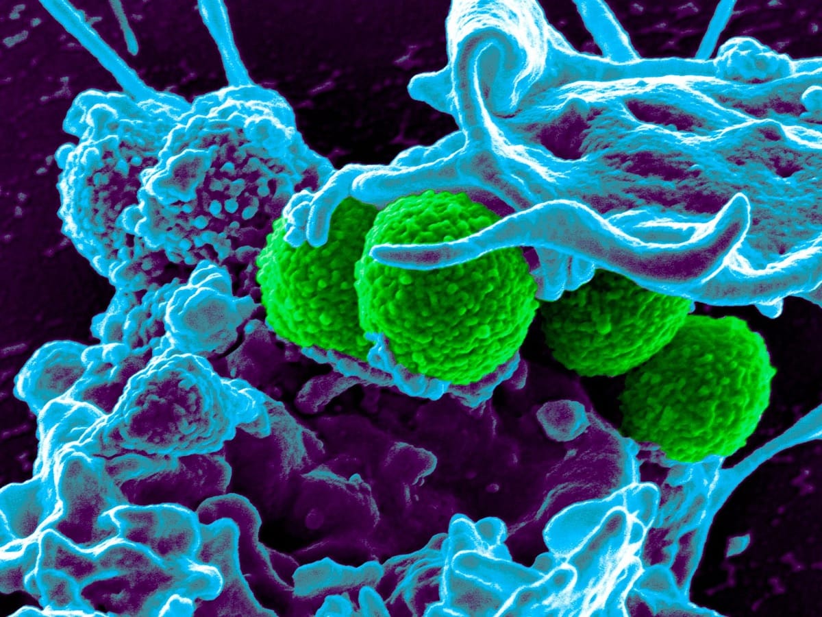 AIIMS director warns danger of germs and superbugs after corona epidemic