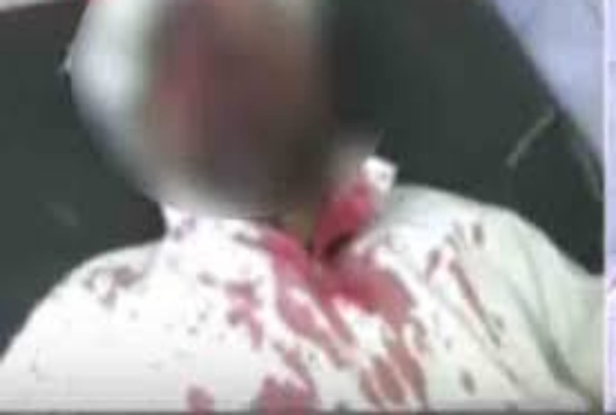 Man killed due to dead rat thrown into the neighbor house