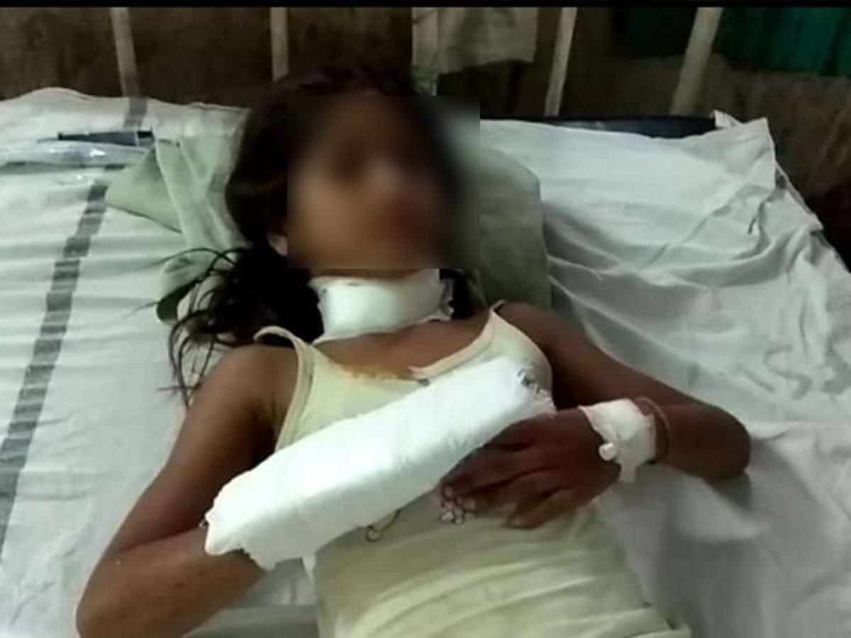 Two minor students attacks on 10 year old girl with blade in Rajasthan