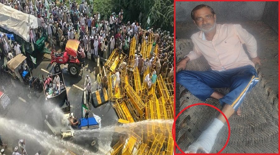 Kisan Movement and beating by police of Many farmers injured