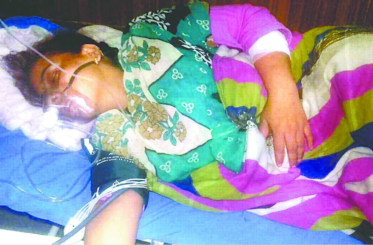 acid attack on a woman in jaspur