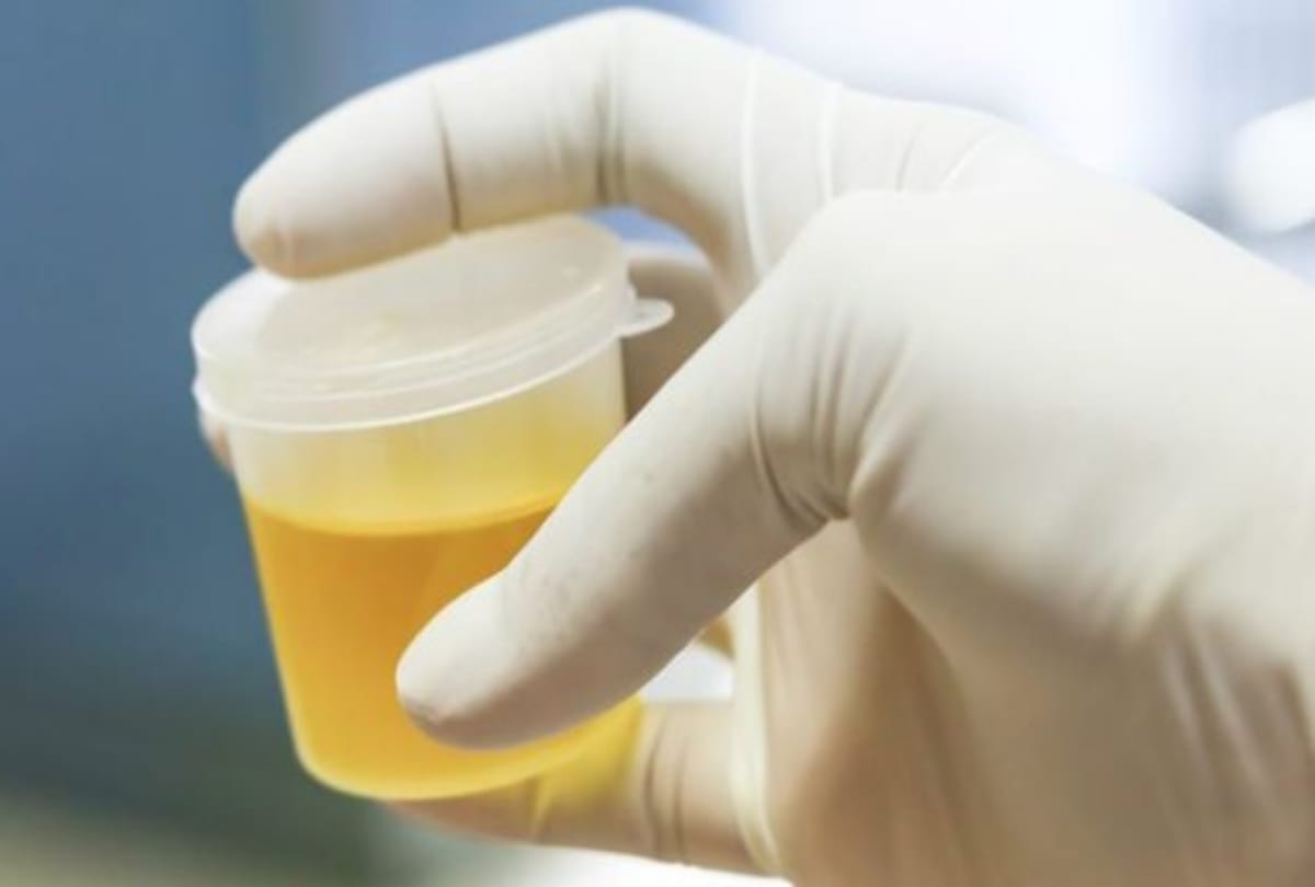 Is drinking urine really good for health