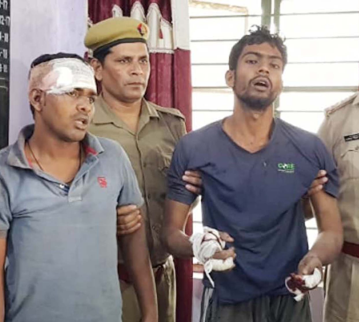 घायल बदमाशों की हालत बिगड़ी
