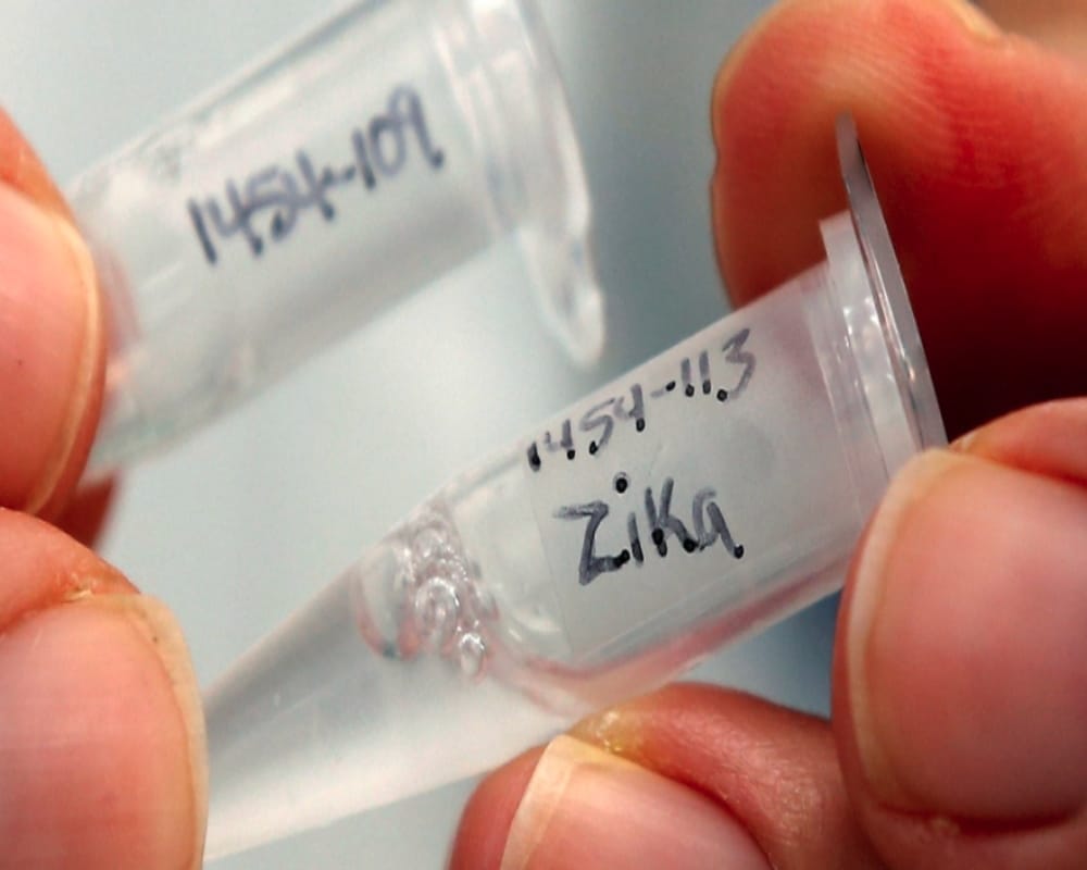 Prevention and History of zika virus spreading through female aedes mosquito bite