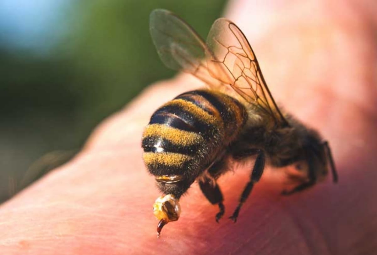 The Lady use bee sting to Acupuncture