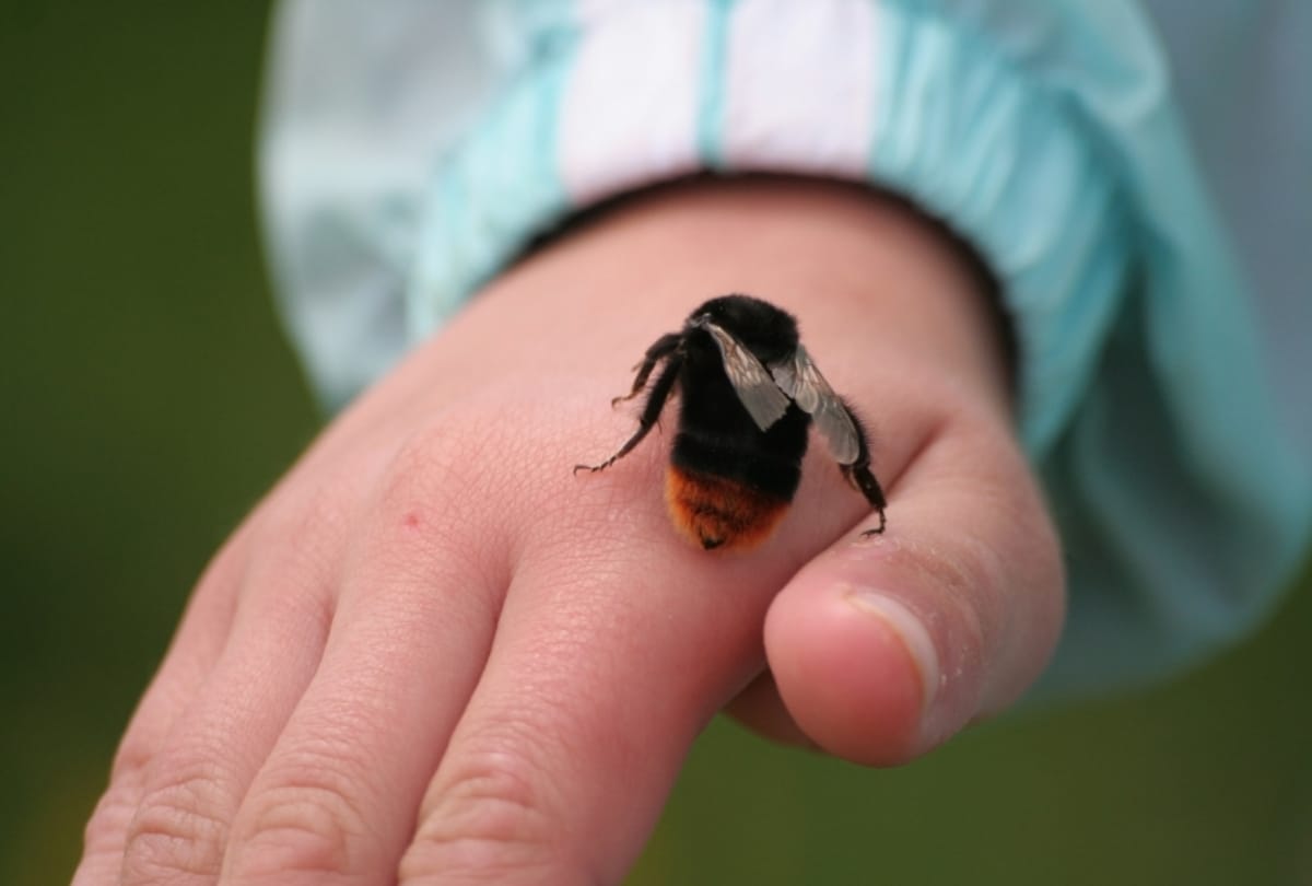 The Lady use bee sting to Acupuncture