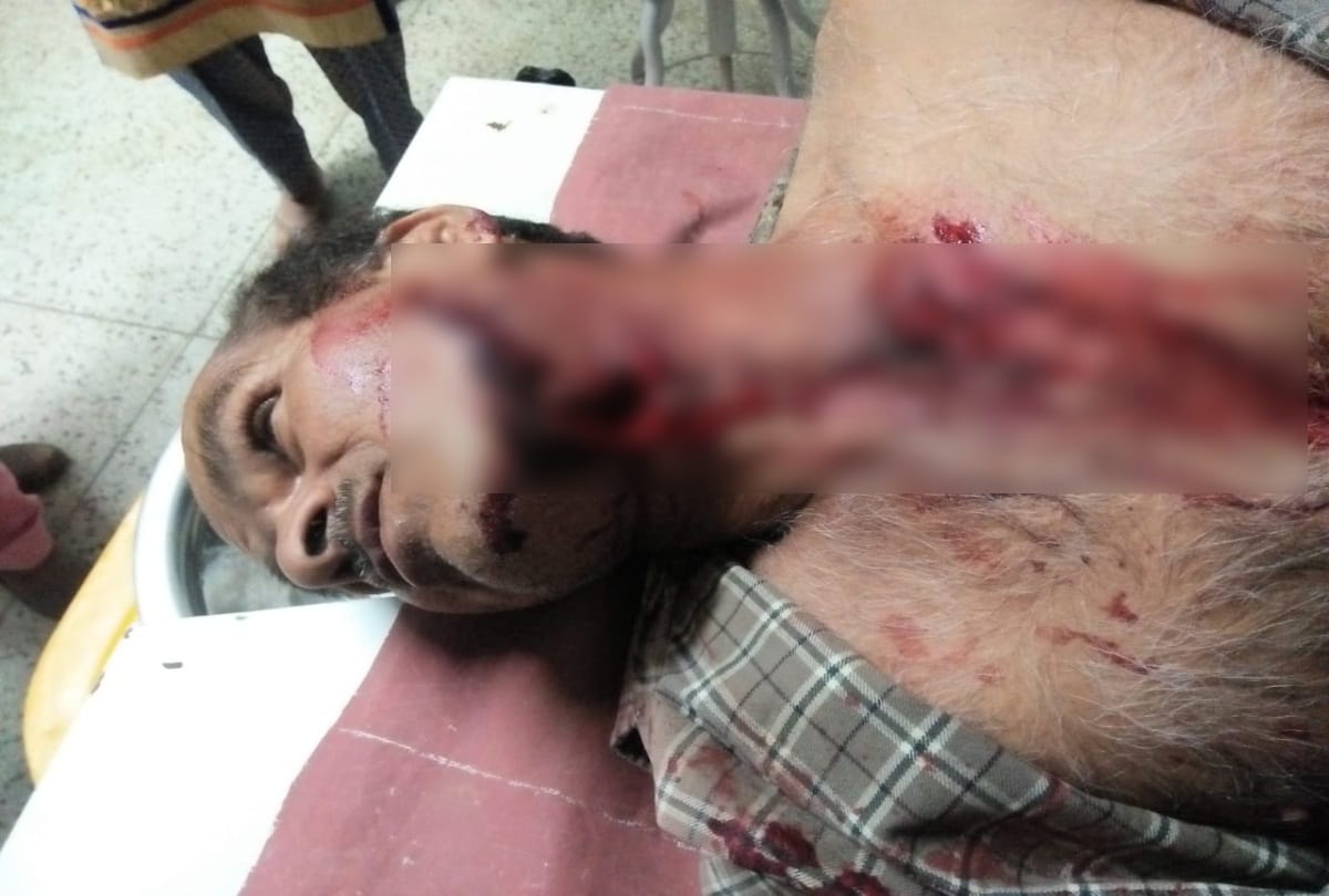 one person injured in a bear attack at anni kullu