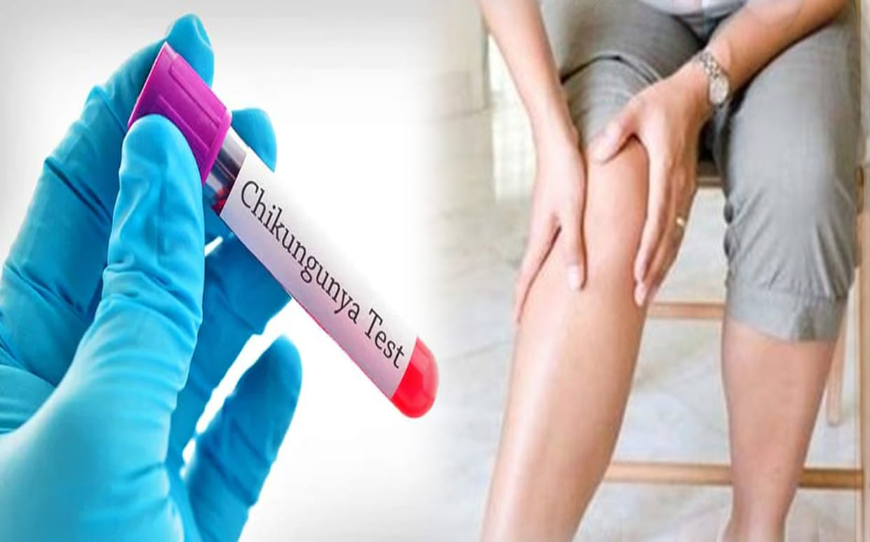After the Rajasthan-Bihar zika virus gave knock in uttar pradesh