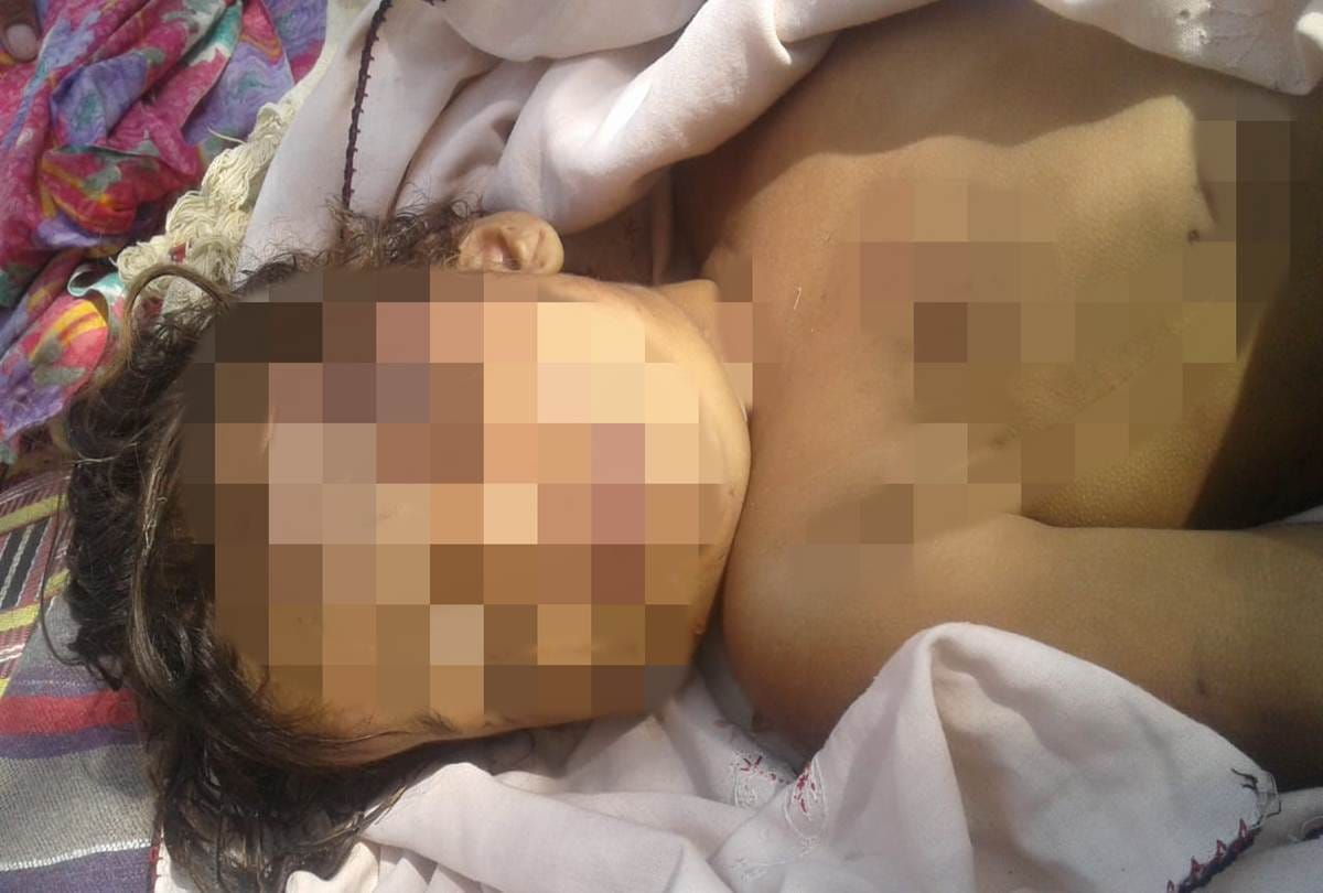 stray dogs killed child in Ramgarh, Samba District, Jammu and Kashmir