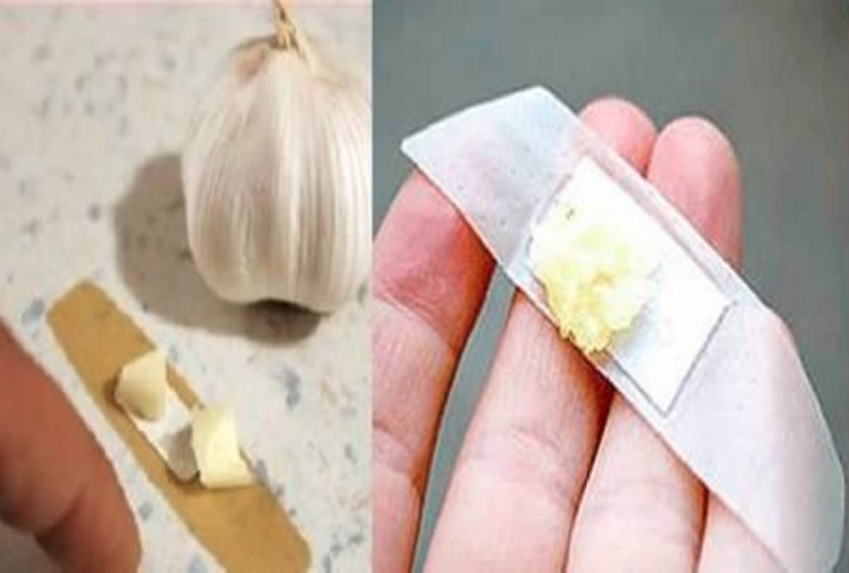 Effective home remedies for mole removal