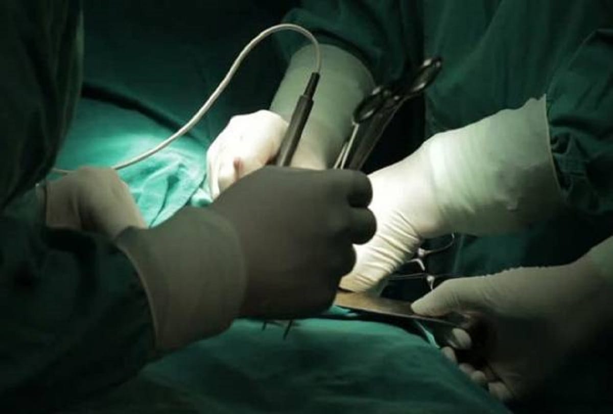 Doctors Find iron Nails In Man's Stomach