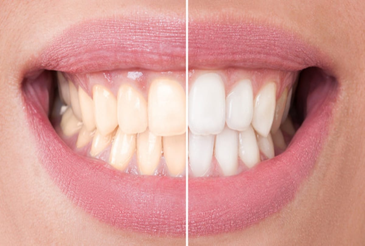 these small tips will make your teeth and gums strong and healthy