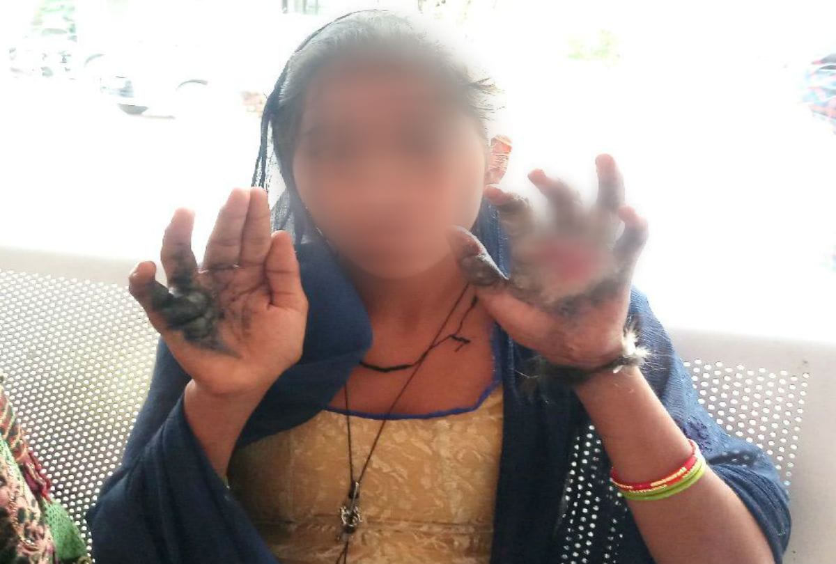 mother in law burnt palm of daughter in law due to doubt in mathura