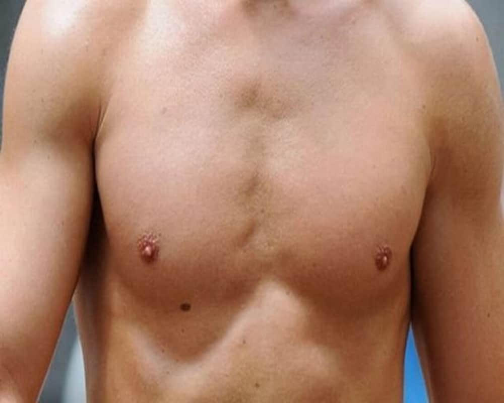 Know how Moles on body that reveal about your relationship