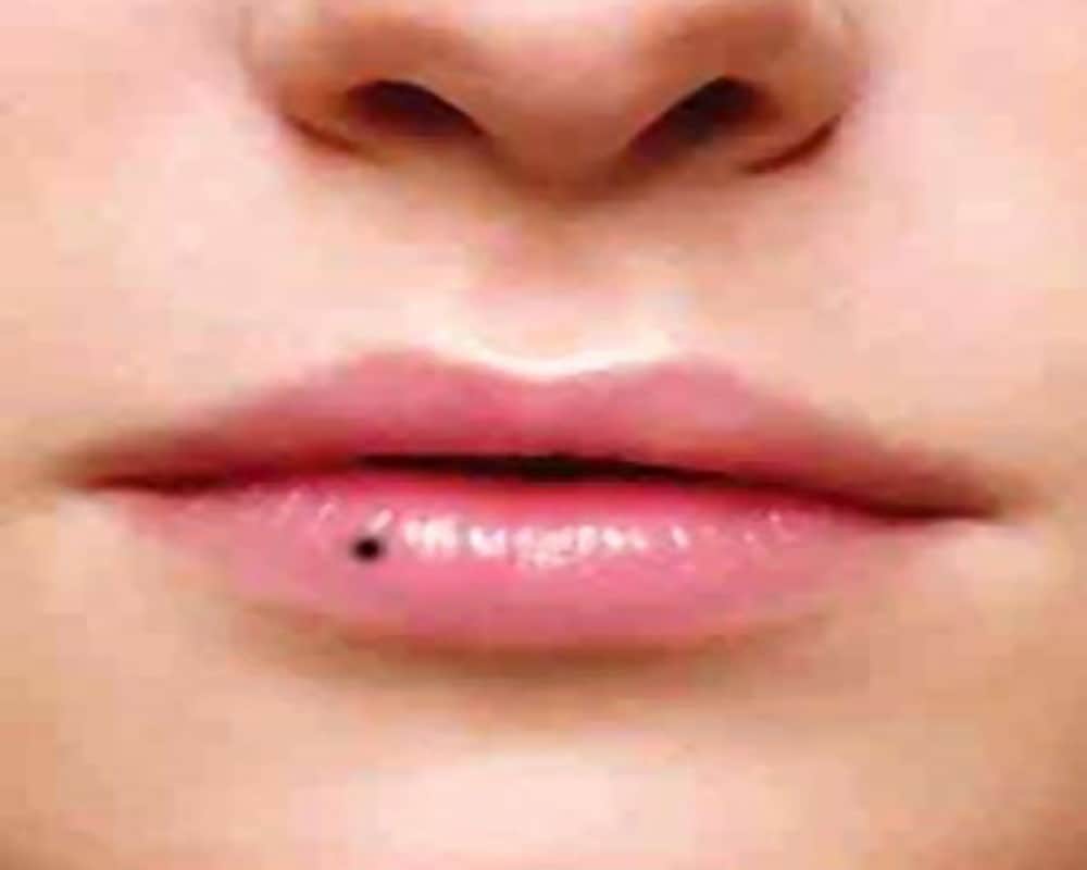 Know how Moles on body that reveal about your relationship