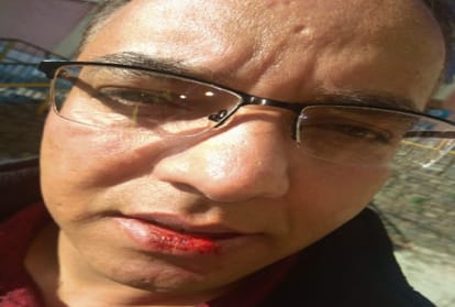Kanoongo attacked on mc shimla Commissioner's private secretary at mall
