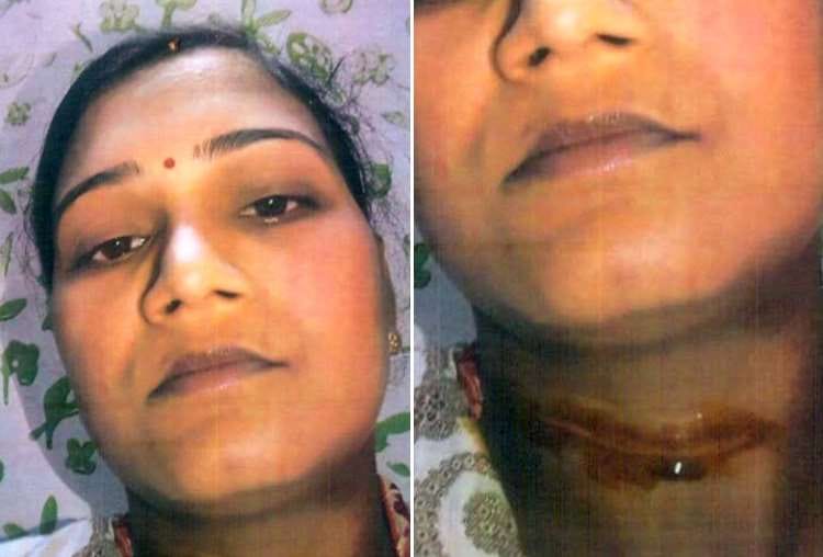 girl injured due to manjha in lucknow