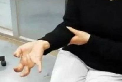 woman unable to move fingers after using mobile chatting in social net on the smartphone