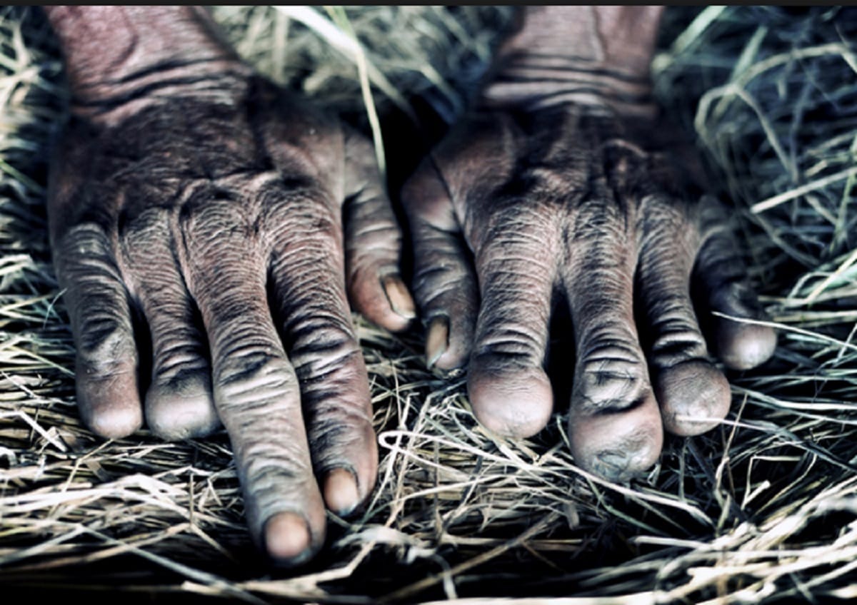 Woman's Finger cut rituals in papua guinea