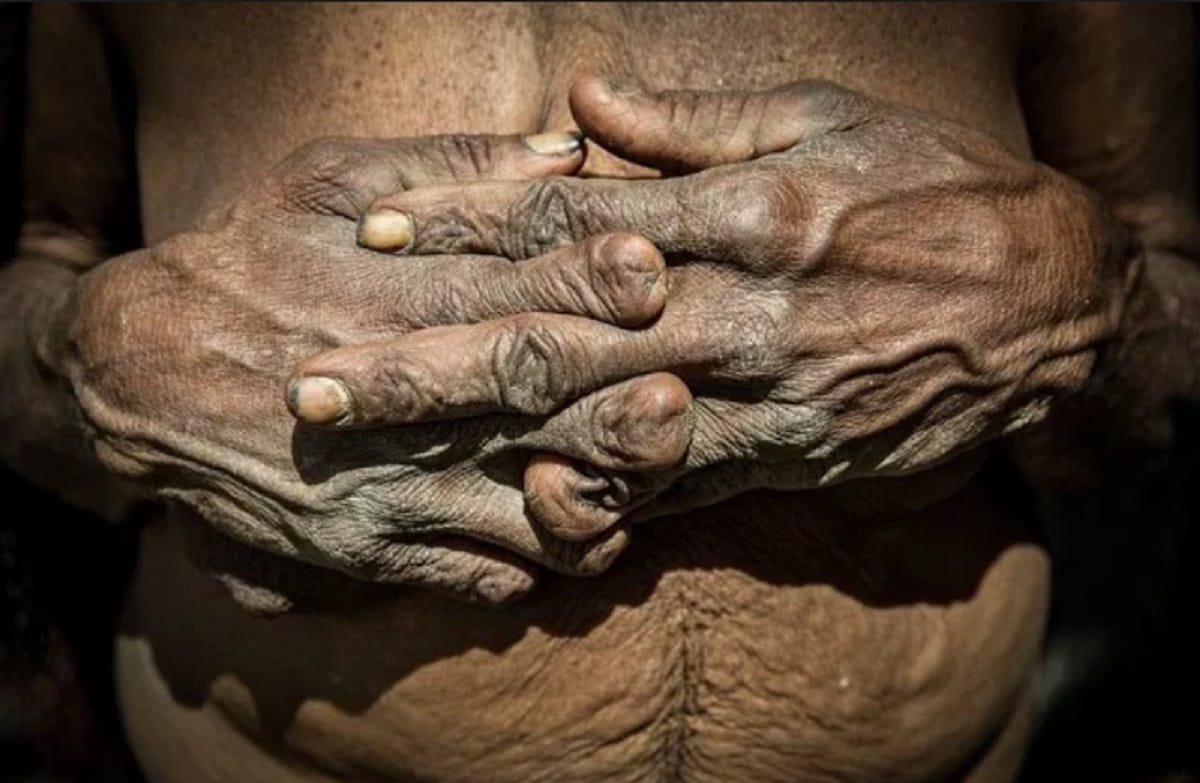 यहां काट दी जाती है महिलाओं की उंगलियां, वजह जानकर गुस्सा आएगा - Woman ...
