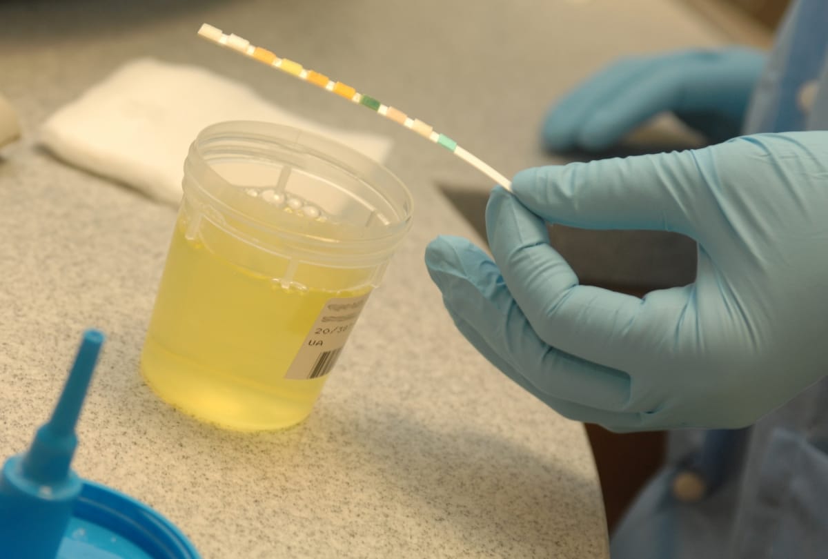 Ancient Roman people used urine for washing mouth and clothes