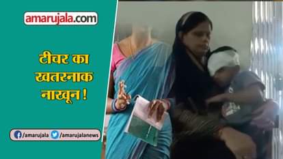 Class 2 student injured after being thrashed by teacher eyes get injured