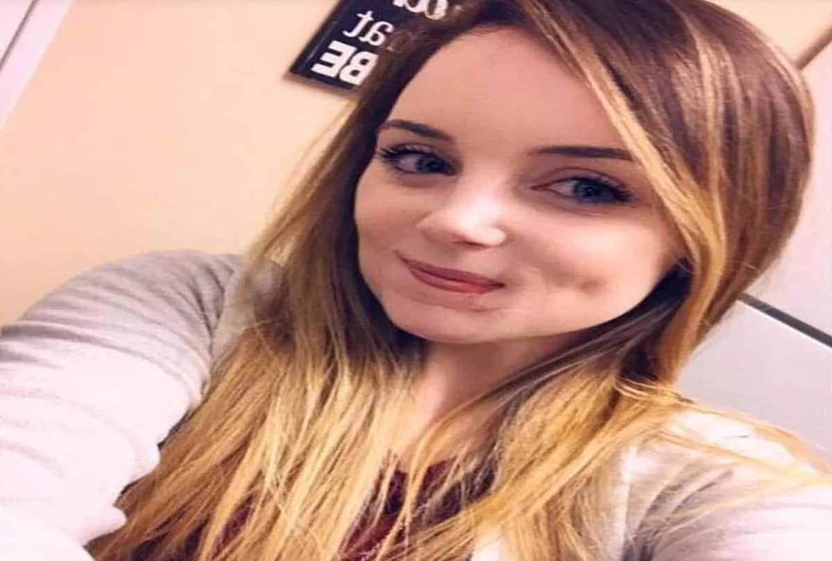 Girlfriend lip bitten off by her ex boyfriend with a strange reason